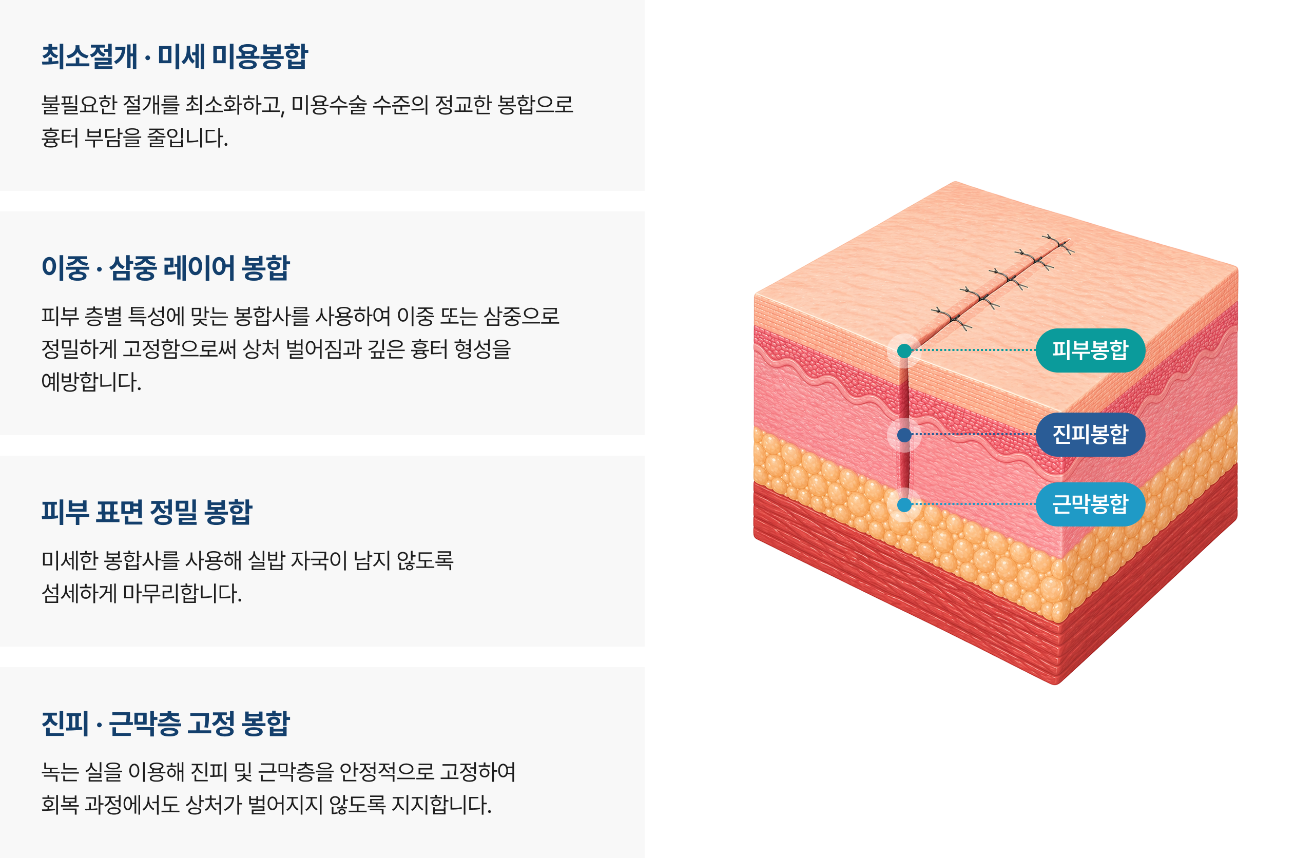 봉합 상세