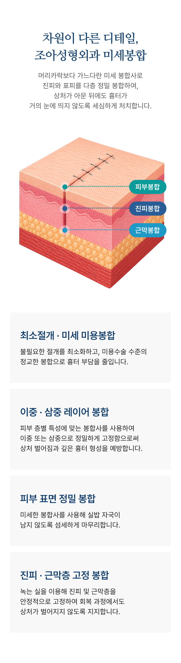 봉합 상세